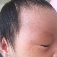 有宝妈知道这是怎么回事吗，帮忙看看谢谢