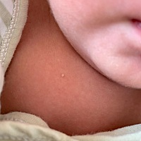 这是啥啊 宝宝有我也有我是怀孕的时候有的