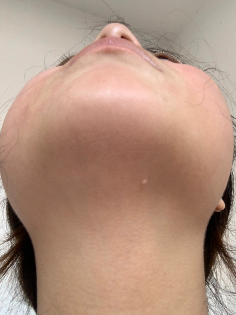 这是啥啊 宝宝有我也有我是怀孕的时候有的