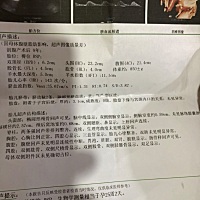 大家帮我看看，能分辨出是男孩还是女孩吗？