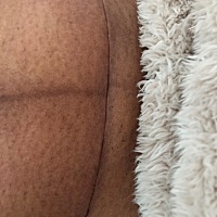 有没有生了肚子很黑的宝妈妈，看着自己的黑色素沉着感觉想死的心都有，不知道能不能恢复，怀孕6个月开始...