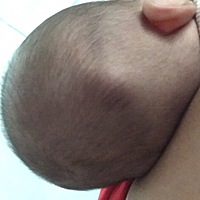 亲们，你们有见过这种情况吗，摸起来硬硬的跟骨头一样，不会走动，打预防针体检医生让不要去摸它说没事...