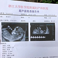 有没有会看单子的，看下男女，好奇的心顶不住了