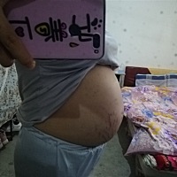 怀孕31周 3天能看出是上怀还是下怀