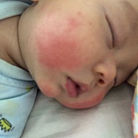 宝宝一天脸红发烫是怎么回事，测温度没发烧。 怎么回事啊？？！