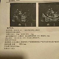 NT  有会看男女的吗