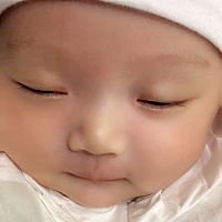 宝宝眼睛周围长了很多湿疹，而且一天比一天多擦了米茶膏不到一个小时就开始见效果了，湿疹太严重宝宝会...