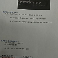 有没有双侧脉络囊肿的宝妈们，要紧？？？