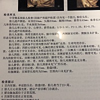 左心房强光斑 这个是什么问题 严重吗