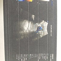 31周了，你们能看出来是乔治还是佩琪吗？