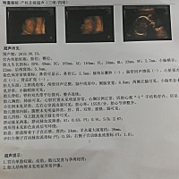 已经生完男宝宝的宝妈可以把你们的四维单拍给看看么？好好奇，别人都说我的是男孩