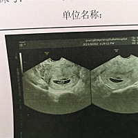 一胎生完才多久 又怀二胎 只求平安健康出世。