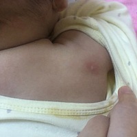 不知道宝宝身上长的什么？上午擦了之前湿疹的膏子早上长的地方都好了，别的地方又开始长了，今天一天都...