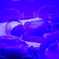 哎。宝贝出来才10天不到。就去受这样的罪。看着好心疼。宝贝你要快点好起来。