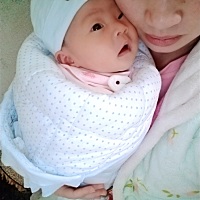 宝妈们。剖腹产满月了要去复查吗？