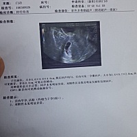 刚开始孕吐胃酸都吐出来了 现在9周了好一些了 早上还是会吐