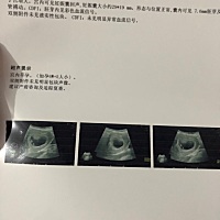 有人会看男孩女孩吗  好奇