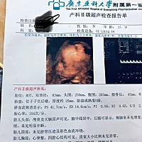 麻烦大家看下是小猪佩奇还是乔治，谢谢