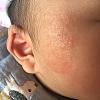 宝妈们知道这是长什么吗？有没有遇到过的呢？