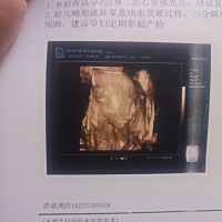 一起帮忙猜男宝女宝