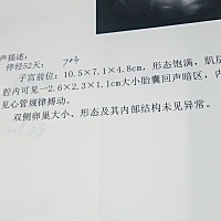 帮忙看看是男孩女孩？