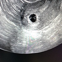 大家帮我看看是不是双胞胎