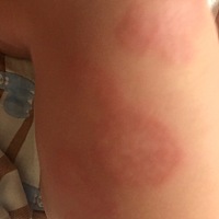 宝宝4个月身上不知道起的是什么东西，脱皮，干干的，看着好心疼。