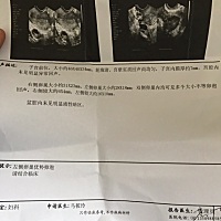 月经干净第12天，中午做的排卵监测！有懂的人帮我看看吧！还多久排出来