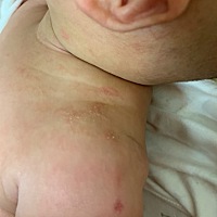 第一次当妈妈，实在没经验，请有经验的人帮我看看我女儿这是长的什么，很急，头上全部都是