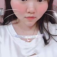 做个双眼皮好多了