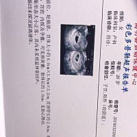 怀孕两个月了，医生说可以要的，好开心，祈祷吧