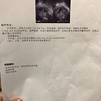 停经42天，3月31号出血至今。有会看的吗