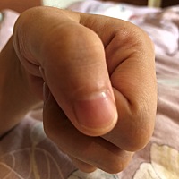 有宝妈跟我一样指甲上面开始慢慢空洞吗？不痛不痒的 指甲快没了