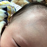 有人知道宝宝脸上长的是什么吗，以前脸干干净净，