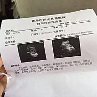 有没有会看男孩，女孩的，宝宝6.7周左右时候做的b超
