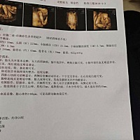 有谁知道怀的是男是女