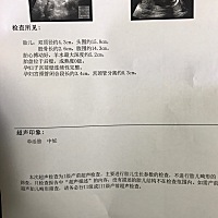孕18周，有做B超宫颈管分离的吗？我的宫颈管分离0.3cm