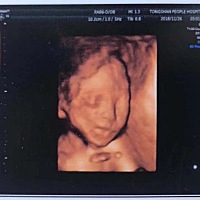 今天宝宝出生的第五天，翻出四维对比，感觉还是有点像的。