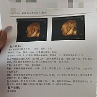 孕28周，能看出男女嘛这个？