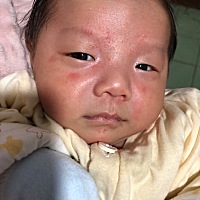 宝宝29天了，最近脸上长了好多痘痘是什么原因，之前脸上干干净净什么都没有。