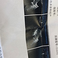 听说初期看Ｂ超孕囊形状和大小就知道男孩女孩，出于好奇就想让会看的亲们帮忙看看，大小是1.9✖️0.9cm...