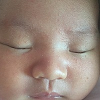 各位宝妈你们知道宝宝脸上长奶藓了怎么办好的快吗？