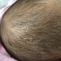 宝宝头上不知长了这是什么，有知道的吗