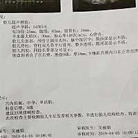 多想看看你  可你却给妈妈一个颜面显示不清的结果😞