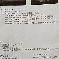 看不清  郁闷