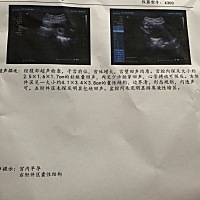 六周多 有褐色分泌物 但是医生说看b超没有问题 很不踏实