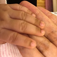 宝宝一个半月，今天突然发现宝宝手指第一节有些发黑，不知道有没有类似情况的宝宝？用不用去看医生啊？