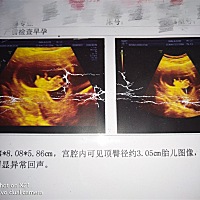 不知道宝贝是乔治还是佩奇。不过希望宝贝健康茁壮成长！