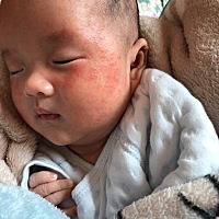 一个多月的宝宝 我想问下这是湿疹么 宝妈们都怎么解决的