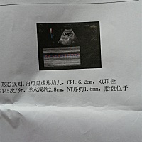 好希望是个佩奇啊，可我怎么觉得这个形状像茄子🍆呢